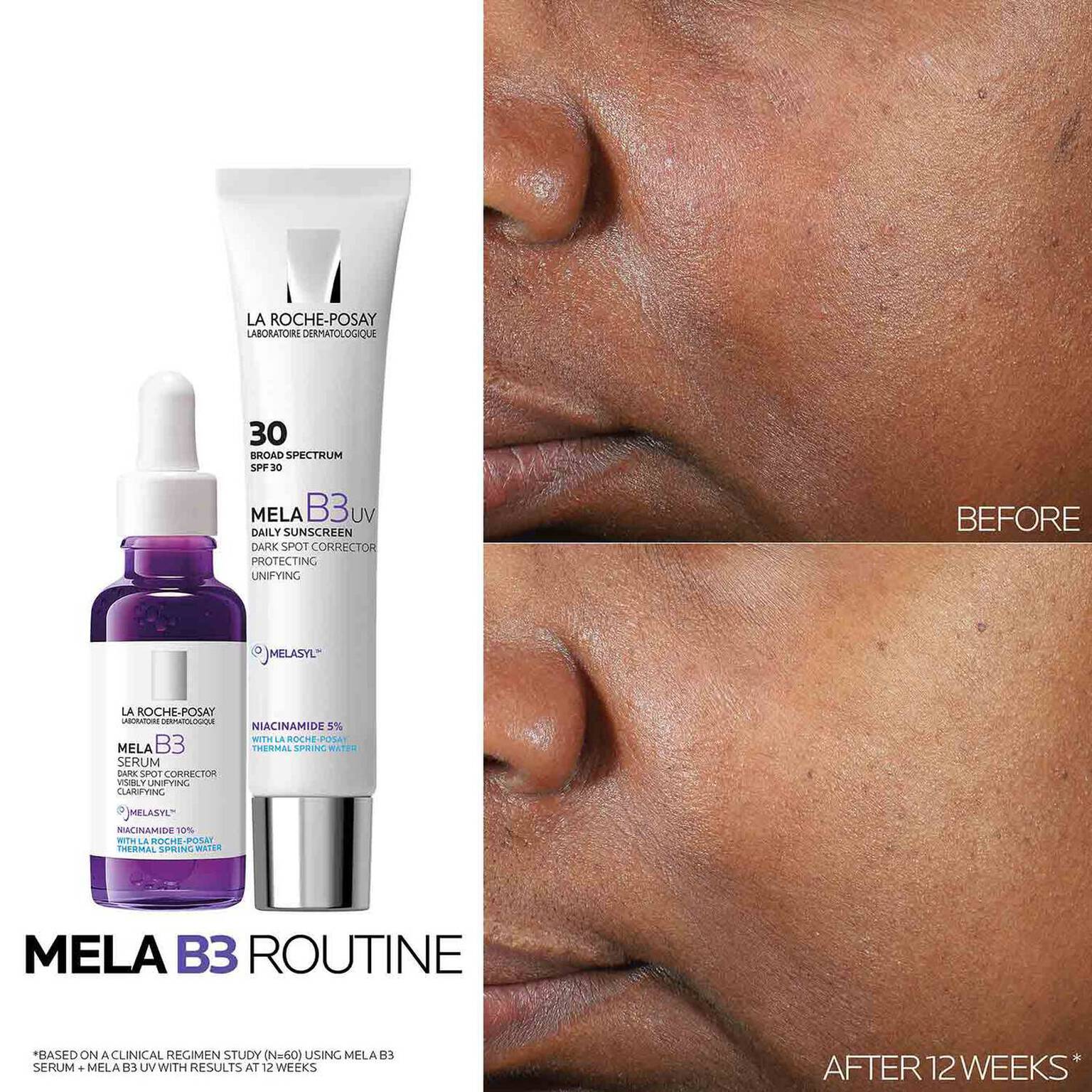 mela-b3-dark-spot-serum-and-mela-b3-uv-daily-moisturizer-with-spf-30-u3 3-Mela-B3-routine_1500X1500.jpg