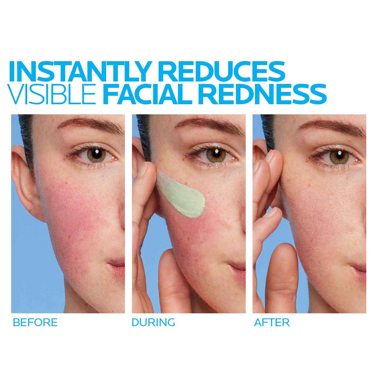 toleriane-rosaliac-ar-face-cream-for-visible-redness-e3 8_Toleriane_Rosaliac-AR-before-after.jpg