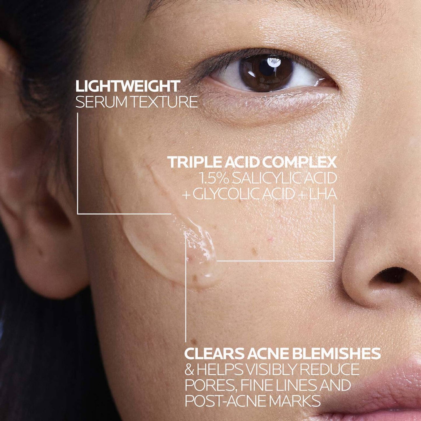 effaclar-salicylic-acid-acne-treatment-serum-a3 LaRochePosay-Product-Effaclar-Effaclar-Serum-30ml-3337875722827-Texture-REV.jpg