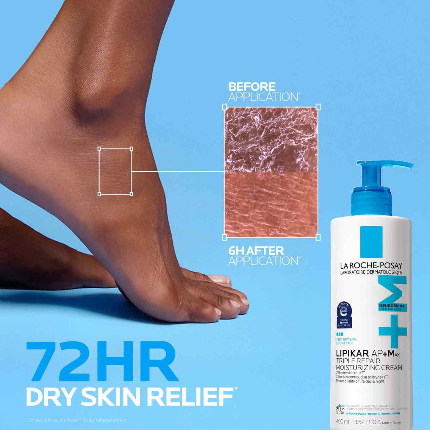 lipikar-ap-max-triple-repair-moisturizing-cream-l9 LaRochePosay-Product-Skincare-Lipikar-Balm-AP+MAX-400ml-3337875941150-ATF-PIM-BeforeAfter.jpg