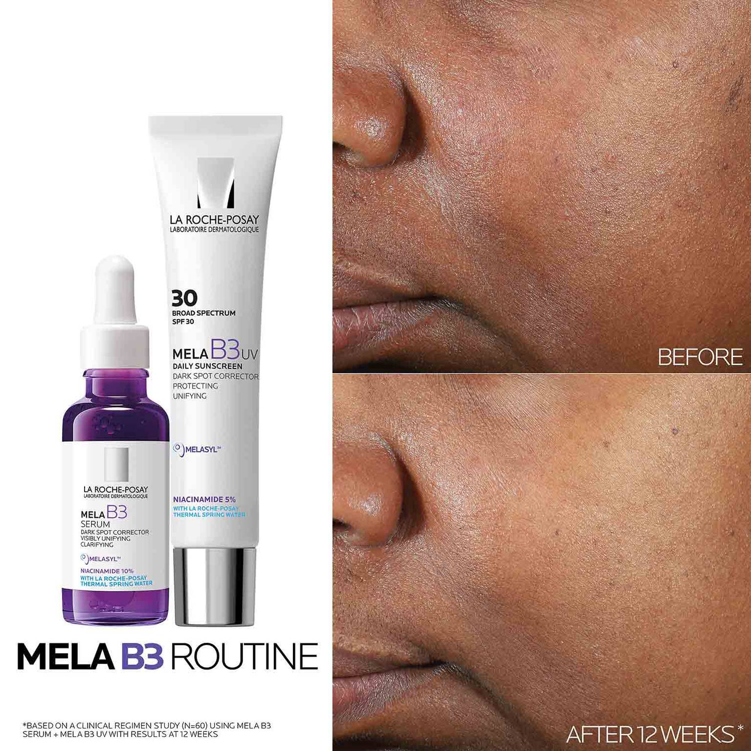 mela-b3-dark-spot-serum-with-melasyltm-niacinamide-b7 Mela-B3-routine_1500X1500.jpg