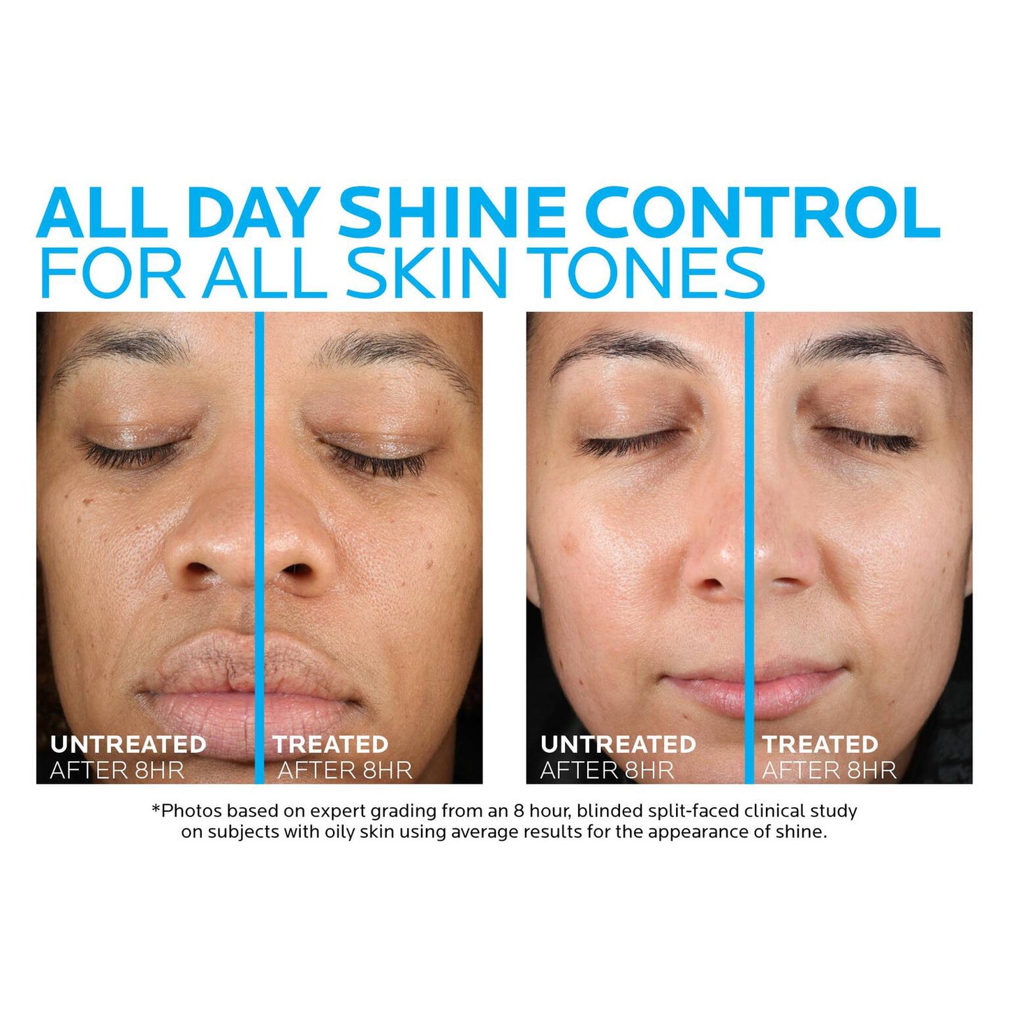 toleriane-double-repair-matte-face-moisturizer-for-oily-skin-d3 la-roche-posay-toleriane-matte-moisturizer-before-and-after-pdp-alt.jpg